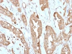 Villin 1 Antibody (VIL1/2310R) - Azide and BSA Free, Novus Biologicals 100 &mu;g | Buy Online | Novus Biologicals | Fisher Scientific